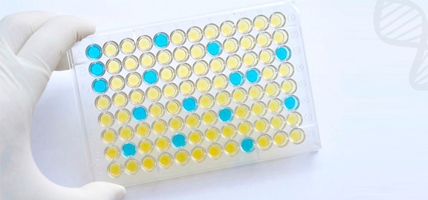 Rat ELISA Kits - High Sensitivity